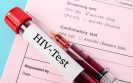 hiv screening