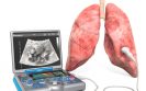 Lung ultrasound scan non-inferior to chest X-ray for COVID-19 pneumonia diagnosis