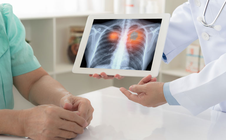 Trastuzumab deruxtecan shows durable anti-cancer activity in non-small-cell lung cancer