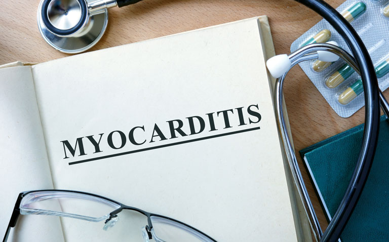 Acute myocarditis linked to higher 90-day all-cause mortality and adverse cardiac outcomes