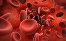 Platelet phenotypes might help personalise treatment