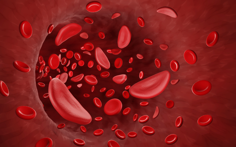 Sickle cell disease patients’ awareness of COVID-19 risks likely responsible for reduced cases
