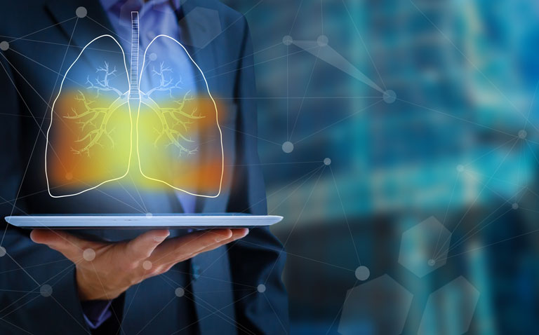 Standalone AI reader could significantly reduce radiologist workload in lung cancer screening