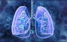Smoking cessation at time of lung cancer diagnosis associated with improved survival