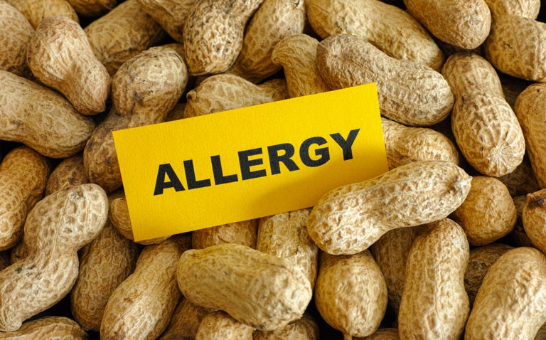 Peanut allergy leads to huge psychosocial burden among sufferers
