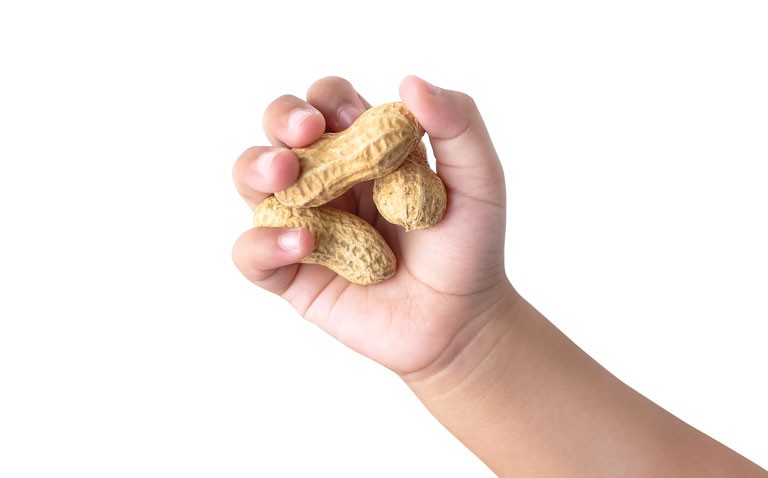 Probiotics added to peanut oral immunotherapy have no effect on remission but reduce GI symptom burden