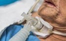 Early tracheostomy improves mortality outcomes in critically ill patients