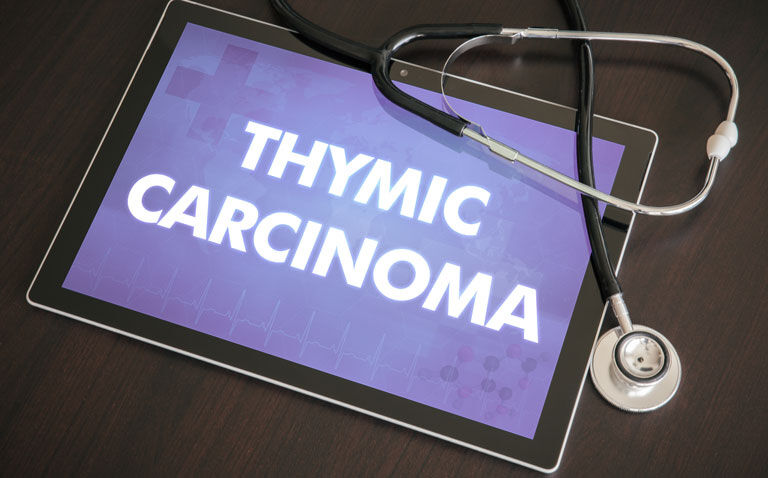 Apatinib therapy promising for thymic epithelial tumours
