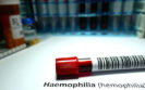 Gene therapy induces sustained and normalised levels of factor IX in haemophilia B