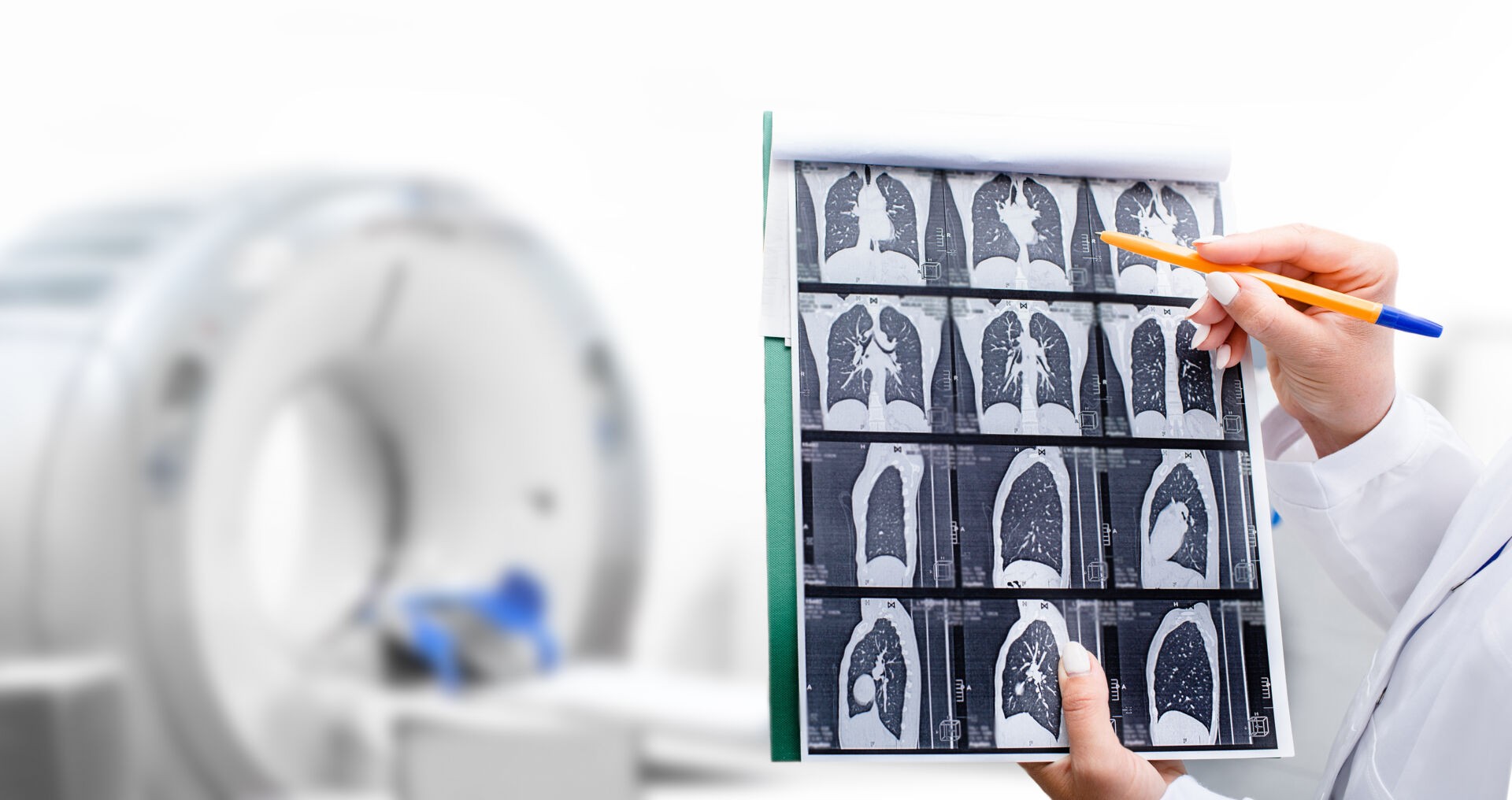 Lung cancer risk 10-fold higher in non-recommended screening groups