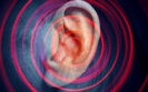 Tinnitus affects millions of adults worldwide