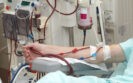 Haemodialysis patients with COVID-19 benefit from remdesivir