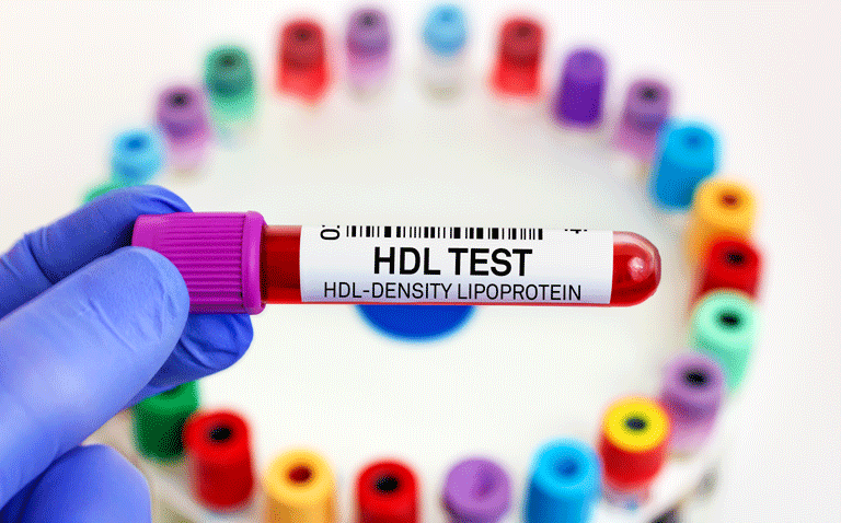 HDL cholesterol protective role questioned