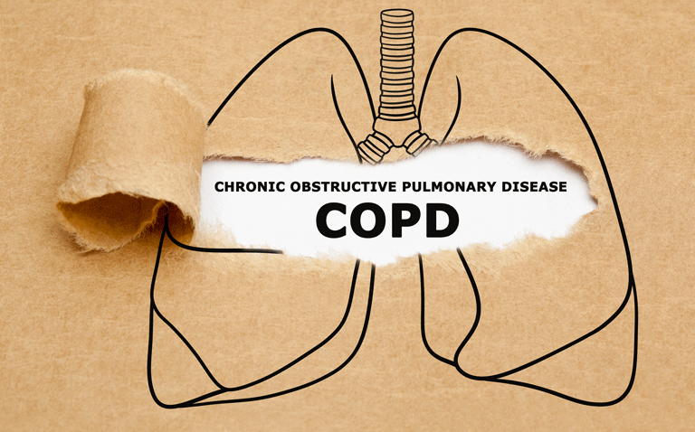 Oral anti-diabetic agents able to reduce COPD exacerbation risk