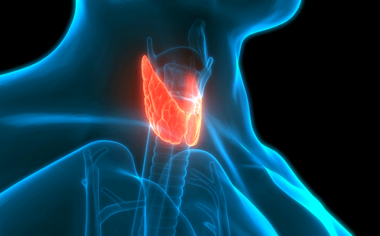 Study suggests thyroid cancer increases coronary heart disease risk