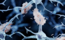 Donanemab provides greater brain amyloid clearance than aducanumab in early Alzheimer's