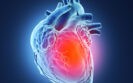 Angina gene therapy reduces ischaemic burden