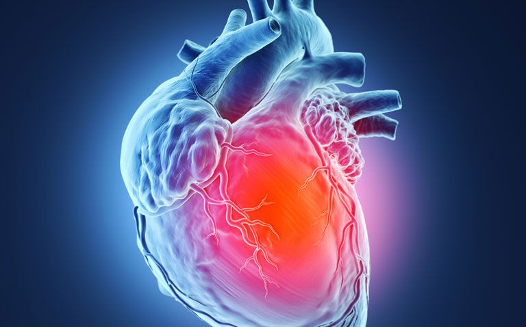 Novel gene therapy reduces ischaemic burden in refractory angina