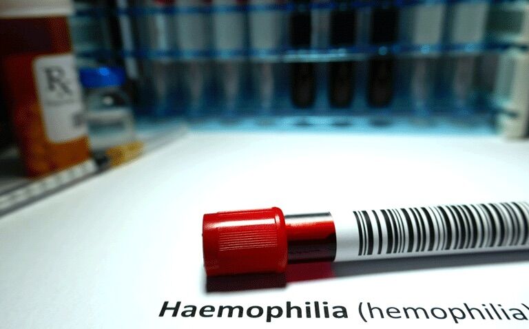 Fidanacogene elaparvovec gene therapy effective for haemophilia B