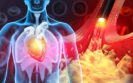 Both forms of cardiovascular disease (CVD) associated with higher cancer risk