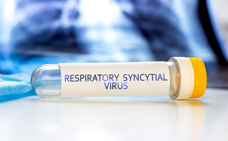 RSV infection during infancy increases subsequent asthma risk