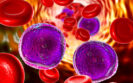 Base-edited CAR7 T cells a potential treatment for relapsed T-cell leukaemia