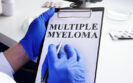 Cilta-cel infusion lowers risk of disease progression in refractory multiple myeloma