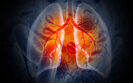 Perioperative pembrolizumab improves event-free survival in early stage lung cancer