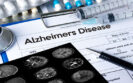 Milestone reached as donanemab shown to slow progress in early Alzheimer disease