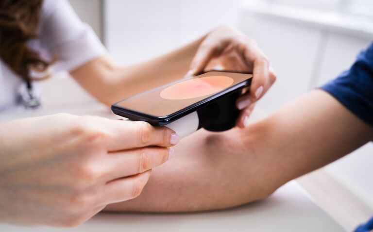 Faster diagnosis and treatment for skin cancer as NHS plans accelerated rollout of teledermatology