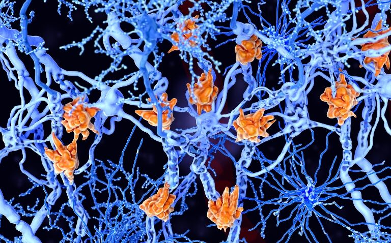 Novel biosimilar receives regulatory green light for multiple sclerosis