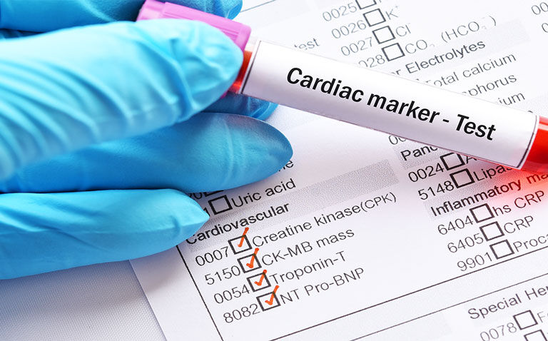 High cardiac troponin level associated with increased mortality risk