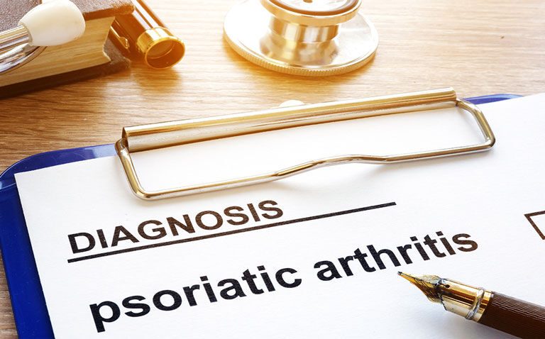 Psoriatic arthritis risk estimation tool reasonably accurate in psoriasis patients, study finds