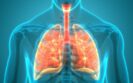 Lung progenitor cell transplant may provide a cure for COPD, study suggests