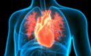 New cardiac troponin assay improves diagnosis and outcomes of acute coronary syndrome