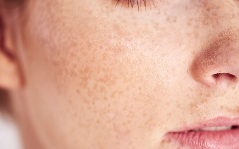 Presence of epidermal haemoglobin may explain skin’s defence against ageing and cancer