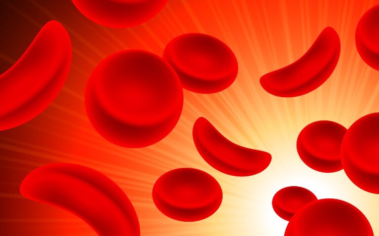 World-first approval for curative exa-cel gene therapy in sickle cell disease