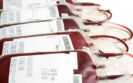 Innovative ‘blood product powder’ may help prevent bleeds in complex cardiac operations