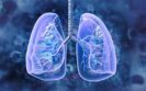 Lung cancer screening could be a ’game changer’ in Scotland, Wales and Northern Ireland