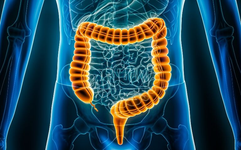 Etrasimod positive opinion for ulcerative colitis upgraded to approval in EU
