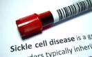 European Commission approves curative exa-cel gene therapy for severe sickle cell disease