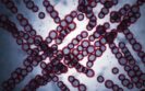 Rezafungin approvals continue as MHRA gives go ahead for use in invasive candidiasis