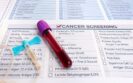 Biomarker and MRI-enhanced strategies comparable for prostate cancer screening, study finds