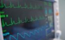 Improvements seen in coronary heart disease rates offset by other cardiovascular conditions