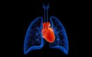 Understanding the new tool that found COPD among key cardiovascular disease risk factors