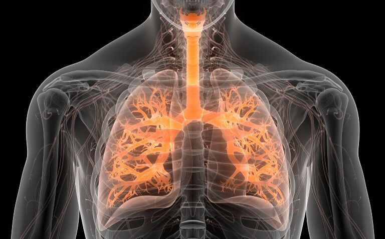 World-first approval for dupilumab in targeting uncontrolled COPD
