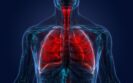 ERS guideline on managing symptoms of severe respiratory illness in adults: expert commentary