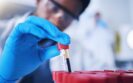 Research digest: The benefits of therapeutic drug monitoring in hypertension