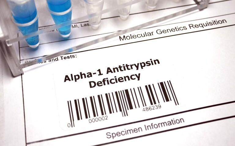 A specimen information form labelled 'Alpha-1 Antitrypsin Deficiency' with barcode and sample vials to illustrate that patients with AATD-COPD may benefit from targeted therapy as bacterial colonisation has been found to predict exacerbation