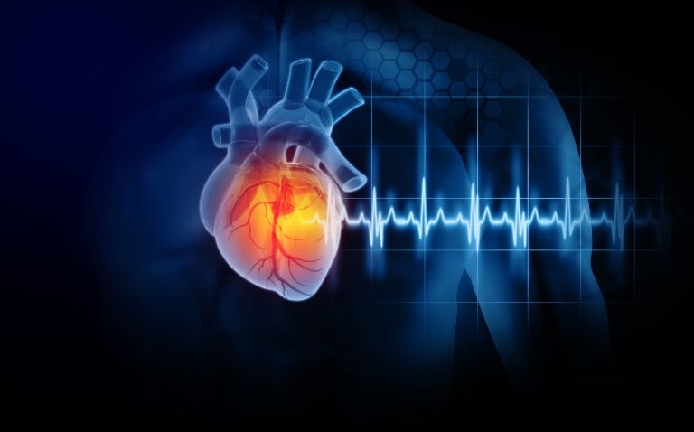 AI tool aids heart attack diagnosis speed and accuracy
